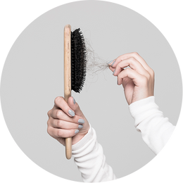 Kausittainen hiustenlähtö